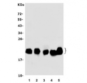 Western blot testing of 1) rat eye ball, 2) mouse eye ball, 3) rat heart, 4) mouse heart and 5) monkey heart lysate with CRYAB antibody. Predicted molecular weight: ~20 kDa.