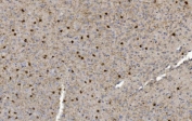 IHC staining of FFPE mouse brain with CRYAB antibody. HIER: boil tissue sections in pH8 EDTA for 20 min and allow to cool before testing.