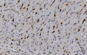 IHC staining of FFPE rat brain with CRYAB antibody. HIER: boil tissue sections in pH8 EDTA for 20 min and allow to cool before testing.