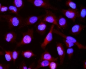 Immunofluorescent staining of FFPE human U-2 OS cells with CRYAB antibody (red) and DAPI nuclear stain (blue). HIER: steam section in pH6 citrate buffer for 20 min.