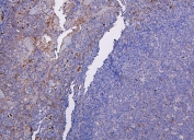 IHC staining of FFPE human tonsil tissue with CXCR2 antibody. HIER: boil tissue sections in pH8 EDTA for 20 min and allow to cool before testing.