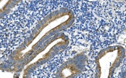 IHC staining of FFPE human appendicitis tissue with DNM1L antibody. HIER: boil tissue sections in pH8 EDTA for 20 min and allow to cool before testing.