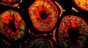 Immunofluorescent staining of FFPE rat testis with DR1 antibody (green). HIER: boil tissue sections in pH8 EDTA for 20 min and allow to cool before testing.
