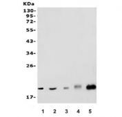 Western blot testing of human 1) SW620, 2) Jurkat, 3) A375, 4) rat testis and 5) mouse testis lysate with DR1 antibody. Predicted molecular weight ~19 kDa.