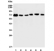 Western blot testing of human 1) A549, 2) SW620, 3) HepG2, 4) rat C6, 5) mouse Neuro-2a and 6) mouse HEPA1-6 lysate with ETS Variant 5 antibody. Expected molecular weight: 58-70 kDa, doublet may be observed.