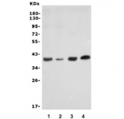 Western blot testing of human 1) placenta, 2) Caco-2, 3) MDA-MB-453 and 4) HepG2 lysate with F11R antibody. Expected molecular weight: 35~43kDa depending on glycosylation level.