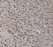 IHC staining of FFPE mouse brain with FOXP1 antibody. HIER: boil tissue sections in pH8 EDTA for 20 min and allow to cool before testing.
