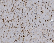 IHC staining of FFPE rat brain with FOXP1 antibody. HIER: boil tissue sections in pH8 EDTA for 20 min and allow to cool before testing.