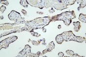 IHC staining of FFPE human placenta with HDAC5 antibody. HIER: boil tissue sections in pH8 EDTA for 20 min and allow to cool before testing.