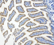IHC staining of FFPE mouse small intestine with HDAC5 antibody. HIER: boil tissue sections in pH8 EDTA for 20 min and allow to cool before testing.