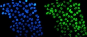 Immunofluorescent staining of FFPE human A431 cells with HDAC5 antibody (green) and DAPI nuclear stain (blue). HIER: steam section in pH6 citrate buffer for 20 min.