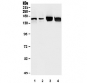 Western blot testing of 1) human K562, 2) human PC-3, 3) rat liver and 4) mouse liver lysate with HDAC5 antibody. Predicted molecular weight ~122 kDa, observed at 122-160 kDa.