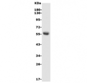 Western blot testing of rat kidney lysate with Hexosaminidase A antibody. Expected molecular weight: ~60 kDa (precursor), ~54 kDa (mature).