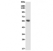 Western blot testing of rat kidney lysate with Hexosaminidase A antibody. Expected molecular weight: ~60 kDa (precursor), ~54 kDa (mature).