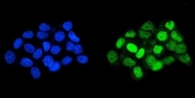 Immunofluorescent staining of FFPE human A431 cells with HOXD11 antibody (green) and DAPI nuclear stain (blue). HIER: steam section in pH6 citrate buffer for 20 min.