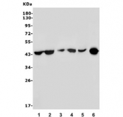 Western blot testing of human 1) K562, 2) HEK293, 3) U-87 MG, 4) A431, 5) A549 and 6) mouse kidney lysate with HOXD11 antibody. Predicted molecular weight ~45 kDa.