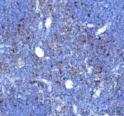 IHC staining of FFPE mouse thymus tissue with Gilt antibody. HIER: boil tissue sections in pH8 EDTA for 20 min and allow to cool before testing.
