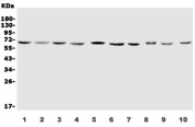 Western blot testing of human 1) Jurkat, 2) K562, 3) Raji, 4) U937, 5) HEK293, 6) HMY2.CIR, 7) ThP-1, 8) rat RH35, 9) rat C6 and 10) mouse HEPA1-6 lysate with IL2RG antibody. Predicted molecular weight: ~42 kDa, can be observed at 64-70 kDa.