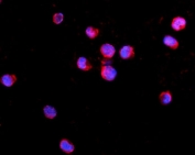 Immunofluorescent staining of FFPE human K562 cells with IL2RG antibody (red) and DAPI nuclear stain (blue). HIER: steam section in pH6 citrate buffer for 20 min.