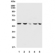 Western blot testing of 1) human K562, 2) human HeLa, 3) rat brain, 4) mouse spleen and 5) mouse SP2/0 lysate with Inhibin alpha antibody. Predicted molecular weight ~40 kDa.