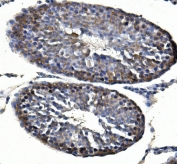 IHC staining of FFPE rat testis with Inhibin alpha antibody. HIER: boil tissue sections in pH8 EDTA for 20 min and allow to cool before testing.