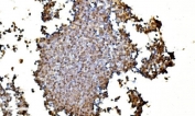 IHC staining of FFPE human appendicitis tissue with LSM2 antibody. HIER: boil tissue sections in pH8 EDTA for 20 min and allow to cool before testing.