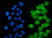 Immunofluorescent staining of FFPE human MCF7 cells with LSM2 antibody (green) and DAPI nuclear stain (blue). HIER: steam section in pH6 citrate buffer for 20 min.