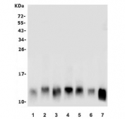 Western blot testing of rat 1) brain, 2) testis, 3) small intestine, 4) C6 and mouse 5) testis, 6) Neuro-2a and 7) HEPA1-6 lysate with LSM2 antibody. Predicted molecular weight: ~10 kDa.