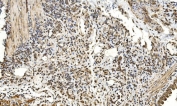 IHC staining of FFPE mouse lung with LSM2 antibody. HIER: boil tissue sections in pH8 EDTA for 20 min and allow to cool before testing.