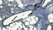 IHC staining of FFPE mouse lung with MCU antibody. HIER: boil tissue sections in pH8 EDTA for 20 min and allow to cool before testing.