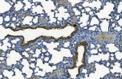 IHC staining of FFPE rat lung with MCU antibody. HIER: boil tissue sections in pH8 EDTA for 20 min and allow to cool before testing.