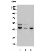 Western blot testing of human 1) placenta, 2) A549 and 3) SW620 lysate with MESP2 antibody. Predicted molecular weight ~45 kDa.