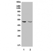 Western blot testing of 1) placenta and 2) A549 lysate with MMP28 antibody. Predicted molecular weight ~48 kDa.