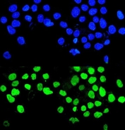 Immunofluorescent staining of FFPE human A431 cells with MMP28 antibody (green) and DAPI nuclear stain (blue). HIER: steam section in pH6 citrate buffer for 20 min.