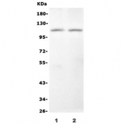 Western blot testing of monkey 1) heart and 2) skeletal muscle with Monkey NOD1 antibody. Predicted molecular weight: ~107 kDa.