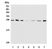 Western blot testing of 1) human HEK293, 2) human SW620, 3) human HeLa, 4) rat RH35, 5) mouse spleen, 6) mouse thymus and 7) mouse NIH 3T3 lysate with NTF4 antibody. Expected molecular weight: 22-45 depending on level of glycosylation.