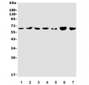 Western blot testing of 1) K562, 2) HEK293, 3) HepG2, 4) PC-3, 5) rat testis, 6) mouse testis and 7) mouse SP2/0 lysate with RIO Kinase 1 antibody. Predicted molecular weight ~65 kDa.