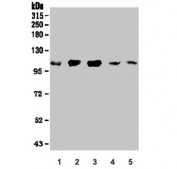 Western blot testing of human 1) HEK293, 2) ThP-1, 3) HL-60 4) rat brain and 5) mouse brain lysate with SEZ6L antibody. Expected molecular weight: 112-200 kDa depending on level of glycosylation.