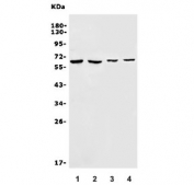 Western blot testing of 1) human HEK293, 2) human HeLa, 3) mouse skeletal muscle and 4) mouse lung lysate with SLC22A3 antibody. Predicted molecular weight: ~61 kDa.