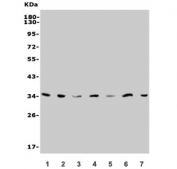 Western blot testing of human 1) HepG2, 2) Jurkat, 3) K562, 4) A549, 5) rat liver, 6) RH35 and 7) mouse HEPA1-6 lysate with SLC25A1 antibody. Predicted molecular weight ~34 kDa.