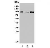Western blot testing of human 1) placenta, 2) Caco-2 and 3) U-2 OS lysate with SOX6 antibody. Predicted molecular weight ~92 kDa. 
