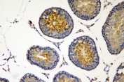 IHC staining of FFPE rat testis with SOX6 antibody. HIER: boil tissue sections in pH8 EDTA for 20 min and allow to cool before testing.