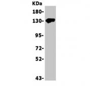 Western blot testing of human Jurkat cell lysate with THBS1 antibody. Expected molecular weight: 130-200 kDa depending on glycosylation level.