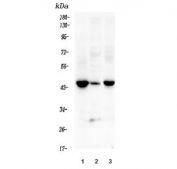 Western blot testing of mouse 1) heart, 2) testis and 3) lung lysate with Fam70b antibody. Predicted molecular weight ~40 kDa.