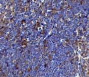 IHC staining of FFPE rat spleen with Tnfrsf17 antibody. HIER: boil tissue sections in pH8 EDTA for 20 min and allow to cool before testing.