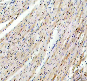 IHC staining of FFPE rat heart tissue with TRIM63 antibody, HRP-secondary and DAB substrate. HIER: boil tissue sections in pH8 EDTA for 20 min and allow to cool before testing.