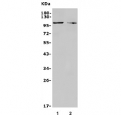 Western blot testing of 1) rat C6 and 2) mouse Neuro-2a antibody with TRPC3 antibody. Predicted molecular weight ~106 kDa.