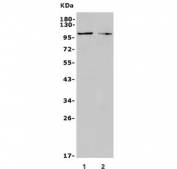 Western blot testing of 1) rat C6 and 2) mouse Neuro-2a antibody with TRPC3 antibody. Predicted molecular weight ~106 kDa.