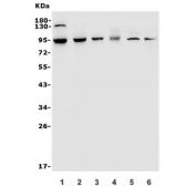 Western blot testing of 1) human A549, 2) human A431, 3) rat brain, 4) mouse brain, 5) mouse heart and 6) mouse lung lysate with TRPV2 antibody. Expected molecular weight: 85-95 kDa depending on glycosylation level.