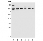 Western blot testing of 1) human A549, 2) human A431, 3) rat brain, 4) mouse brain, 5) mouse heart and 6) mouse lung lysate with TRPV2 antibody. Expected molecular weight: 85-95 kDa depending on glycosylation level.